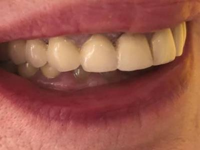 Zabiegi stomatologiczne 11