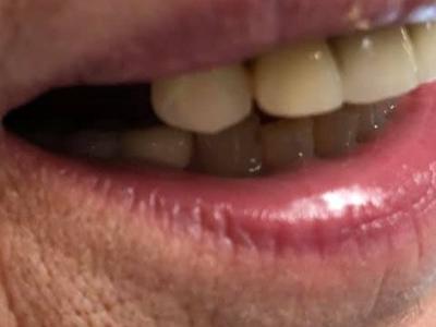 Zabiegi stomatologiczne 10