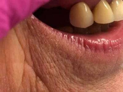 Zabiegi stomatologiczne 9