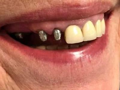 Zabiegi stomatologiczne 8