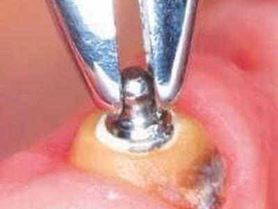 Zabiegi stomatologiczne 7