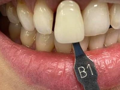 Zabiegi stomatologiczne 14