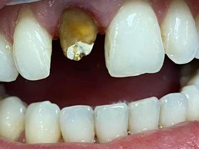 Zabiegi stomatologiczne 12