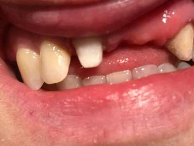 Zabiegi stomatologiczne 20