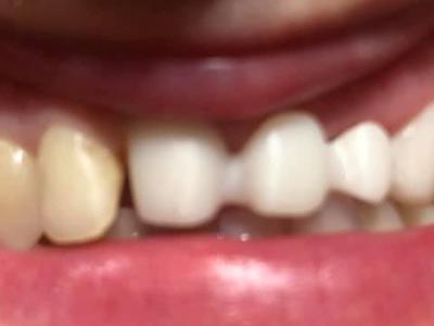 Zabiegi stomatologiczne 19