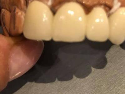 Zabiegi stomatologiczne 18