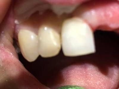 Zabiegi stomatologiczne 17