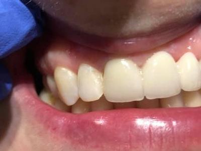 Zabiegi stomatologiczne 16