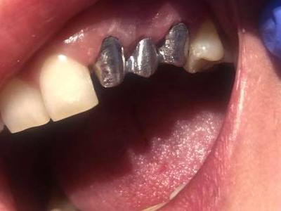 Zabiegi stomatologiczne 24