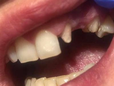 Zabiegi stomatologiczne 23