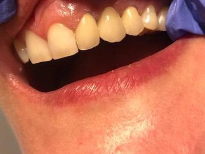 Zabiegi stomatologiczne 22