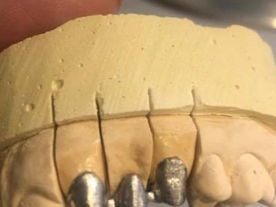 Zabiegi stomatologiczne 21